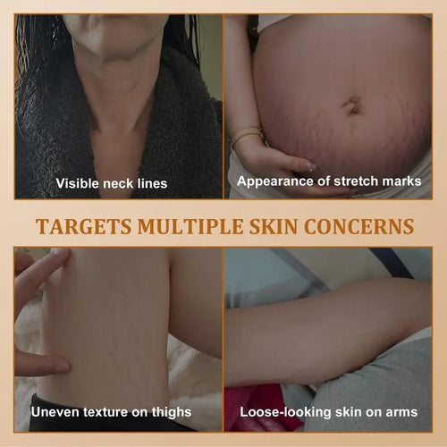 Neck Firming Cream, Upgraded Formula